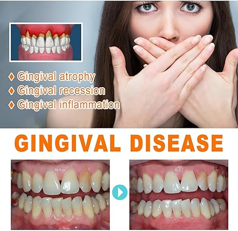 Gum Repair Essence Ampoules And Teeth Whitening Serum - 7pcs*1.5ml
